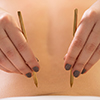 Acupuncture Pain Relief in Chicago IL
