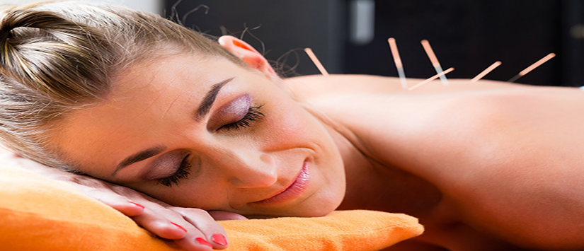 Acupuncture Chicago Pain Relief