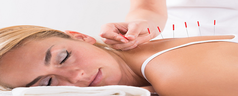 Acupuncture Chicago Pain Relief