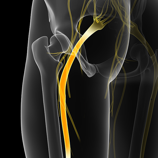 Acupuncture Chicago | Sciatica Pain Relief