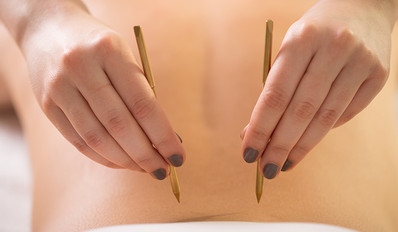 Acupuncture Chicago | Acupressure Treatment